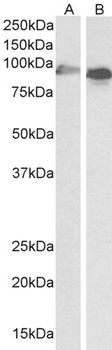 SCARB1 / SR-BI Antibody