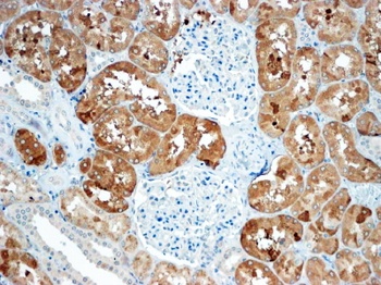 CX3CL1 / fractalkine Antibody