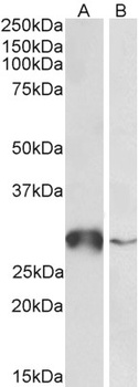 LDHB Antibody
