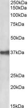 Peripherin 1 Antibody