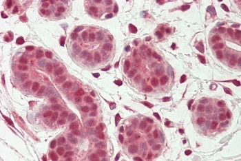 LDHB Antibody