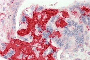 SERPINB1 Antibody