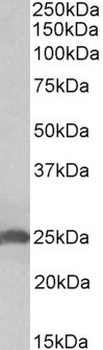 proSAAS Antibody