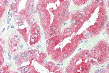 SLC26A1 / SAT-1 Antibody
