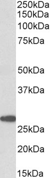 GLP1R Antibody