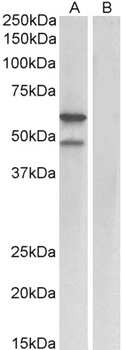 ENPP2 / AUTOTAXIN Antibody