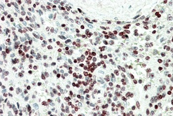 HOXC6 Antibody