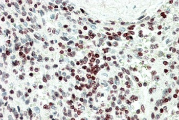 HOXC6, Antibody