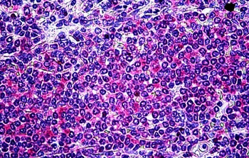 neuronal pentraxin 1 Antibody