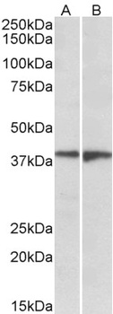 EEF1E1/AIMP3/p18 Antibody