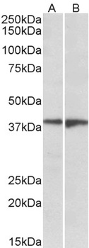 EEF1E1 / AIMP3 / p18 Antibody