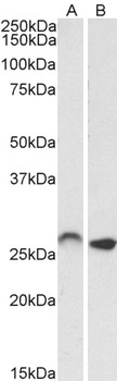 ITK Antibody