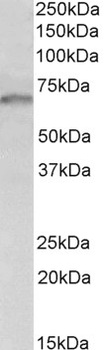 PRPF6 Antibody