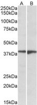 EDG8 / SPPR1 Antibody