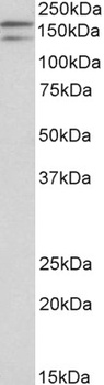 KIT / CD117 Antibody