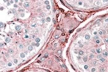 Cytochrome B Reductase 1 Antibody