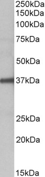 CCDC3 Antibody