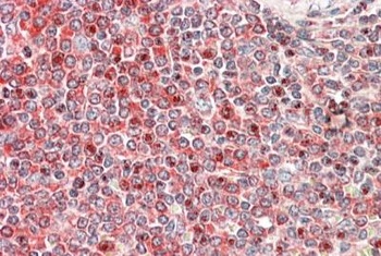 BPIFA1 / PLUNC Antibody
