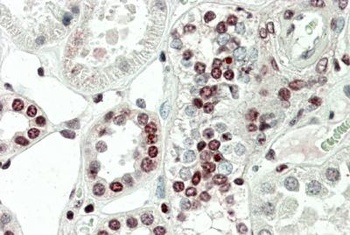 MK5 / MAPKAPK5 Antibody