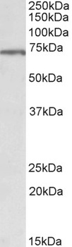 TNNT3 Antibody