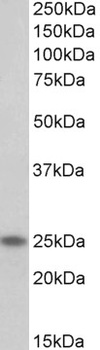 MLC1 Antibody