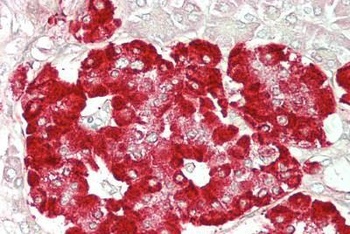 BPIFA1 / PLUNC Antibody