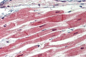 IRAK4 Antibody