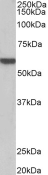 UROD Antibody