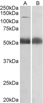 RPL23 Antibody