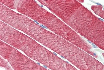 MRG/MORF4L binding protein Antibody