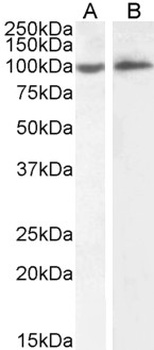 TSPAN5 / NET-4 Antibody