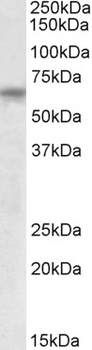 ANTXR2/CMG2 Antibody