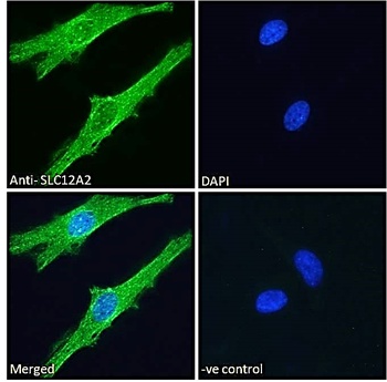 BICC1 Antibody