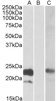 CHRNA7 Antibody