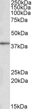 RIP140 Antibody