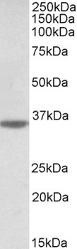NLGN4X Antibody