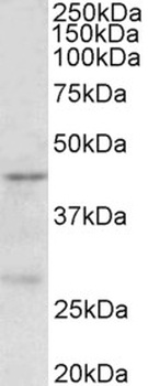 UBN1 Antibody