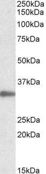 PRMT7 Antibody