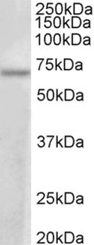 SDCCAG8 Antibody