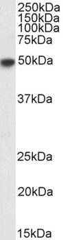 SRD5A1 Antibody
