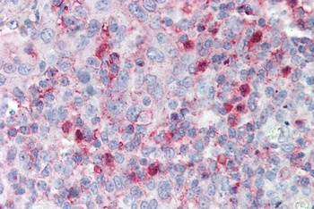 SLC6A4 Antibody