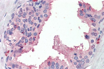 SLC6A8 Antibody