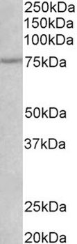 SLC47A2 Antibody