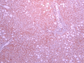 Pard3b Antibody