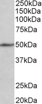 KLHDC8B Antibody