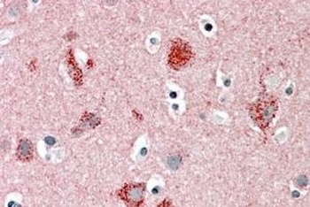 MUNC18 Antibody