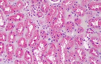 NPPA Antibody