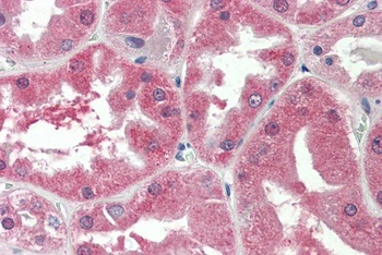 SIM1 Antibody