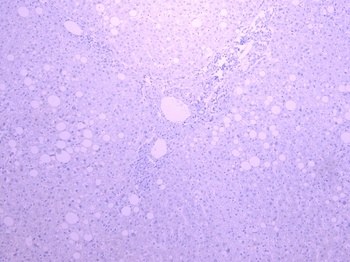 MYO1B Antibody