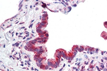 KDM2A Antibody